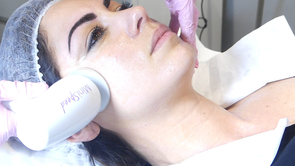 Accent Prime est la plateforme la plus avancée d’Alma laser concernant l’aspect de la peau, le raffermissant et le remodelage esthétique. C’est une combinaison brevetée d’une technologie d’ondes ultra sonore avec de la radiofréquence qui distribue une énergie concentrée.